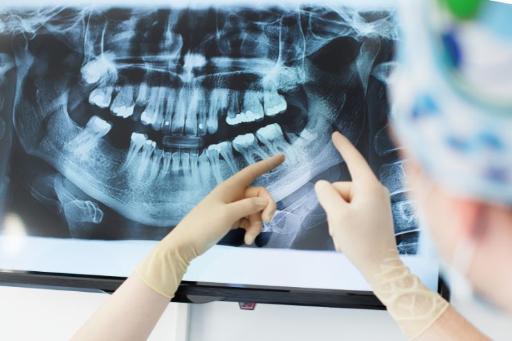 Dental X-Ray